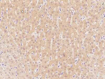 Immunohistochemistry-Paraffin: ALDH8A1 Antibody [NBP2-99392] - Immunochemical staining of human ALDH8A1 in human liver with rabbit polyclonal antibody at 1:1000 dilution, formalin-fixed paraffin embedded sections.