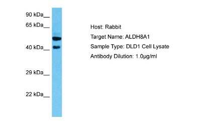 Western Blot: ALDH8A1 Antibody [NBP2-84419] - Host: Rabbit. Target Name: ALDH8A1. Sample Tissue: Human DLD1 Whole Cell lysates. Antibody Dilution: 1ug/ml