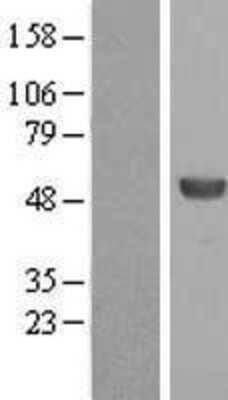 Western Blot ALDH8A1 Overexpression Lysate