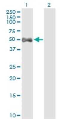 Western Blot: ALDH9A1 Antibody (3C6) [H00000223-M01] - Analysis of ALDH9A1 expression in transfected 293T cell line by ALDH9A1 monoclonal antibody (M01), clone 3C6.Lane 1: ALDH9A1 transfected lysate (Predicted MW: 53.8 KDa).Lane 2: Non-transfected lysate.