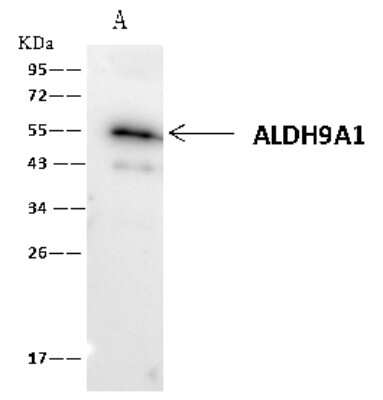 Immunoprecipitation: ALDH9A1 Antibody [NBP2-99130] - ALDH9A1 was immunoprecipitated using: Lane A: 0.5 mg Hela Whole Cell Lysate. 1 ul anti-ALDH9A1 rabbit polyclonal antibody and 60 ug of Immunomagnetic beads. Protein A/G. Primary antibody: Anti-ALDH9A1 rabbit polyclonal antibody, at 1:500 dilution. Secondary antibody: Clean-Blot IP Detection Reagent (HRP) at 1:1000 dilution. Developed using the ECL technique. Performed under reducing conditions. Predicted band size: 54 kDa. Observed band size: 55 kDa