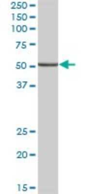 Western Blot: ALDH9A1 Antibody [H00000223-B01P] - Analysis of ALDH9A1 expression in human liver.