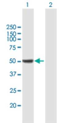 Western Blot: ALDH9A1 Antibody [H00000223-B01P] - Analysis of ALDH9A1 expression in transfected 293T cell line by ALDH9A1 polyclonal antibody.  Lane 1: ALDH9A1 transfected lysate(54.34 KDa). Lane 2: Non-transfected lysate.