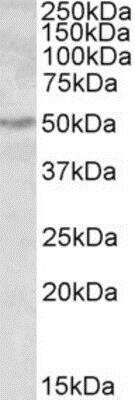 Western Blot: ALDH9A1 Antibody [NBP1-52055] - NBP1-52055 (0.3ug/ml) staining of Human Kidney lysate (35ug protein in RIPA buffer). Primary incubation was 1 hour. Detected by chemiluminescence.