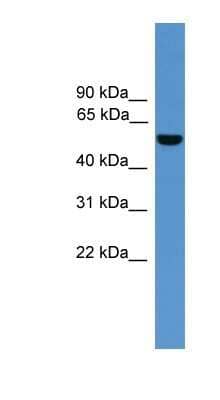 Western Blot: ALDH9A1 Antibody [NBP1-69138] - Titration: 0.2-1 ug/ml, Positive Control: Human Liver.