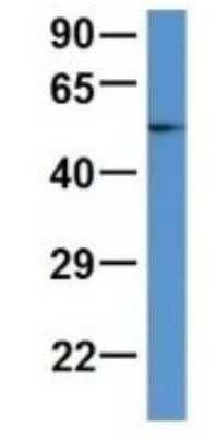 Western Blot: ALDH9A1 Antibody [NBP1-69138] - Human Adult Placenta, Antibody Dilution: 1.0 ug/ml.