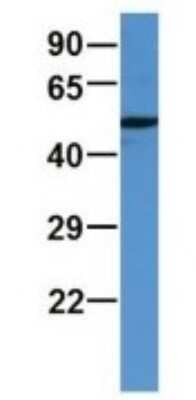 Western Blot: ALDH9A1 Antibody [NBP1-69138] - Human Fetal Brain, Antibody Dilution: 1.0 ug/ml.