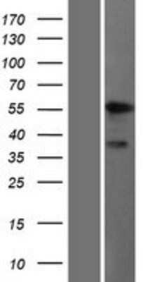 Western Blot: ALDH9A1 Overexpression Lysate (Adult Normal) [NBP2-09000] Left-Empty vector transfected control cell lysate (HEK293 cell lysate); Right -Over-expression Lysate for ALDH9A1.