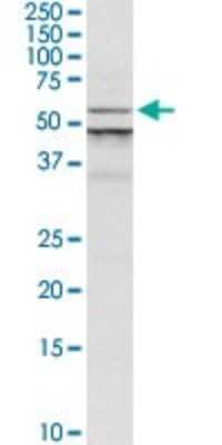 Western Blot: ALG1 Antibody [H00056052-D01P] - Analysis of ALG1 expression in MCF-7.