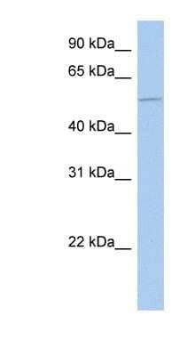 Western Blot: ALG1 Antibody [NBP1-62497] - NTERA2 cell lysate, concentration 0.2-1 ug/ml.