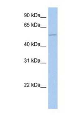 Western Blot: ALG1 Antibody [NBP1-69510] - This Anti-ALG1 antibody was used in Western Blot of NTERA2 tissue lysate at a concentration of 1ug/ml.