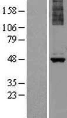 Western Blot: ALG1 Overexpression Lysate (Adult Normal) [NBL1-07463] Left-Empty vector transfected control cell lysate (HEK293 cell lysate); Right -Over-expression Lysate for ALG1.