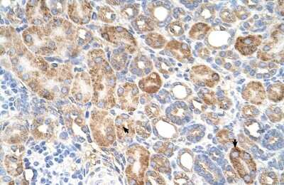 Immunohistochemistry-Paraffin ALG11 Antibody