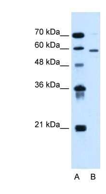 Western Blot ALG11 Antibody