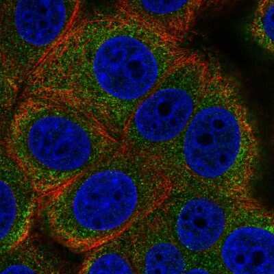 Immunocytochemistry/Immunofluorescence: ALG12 Antibody [NBP2-58353] - Staining of human cell line MCF7 shows localization to endoplasmic reticulum.