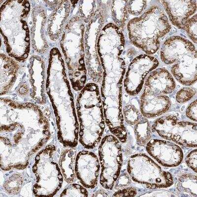 Immunohistochemistry-Paraffin: ALG12 Antibody [NBP2-14282] - Staining of human kidney shows strong granular cytoplasmic positivity in renal tubules.