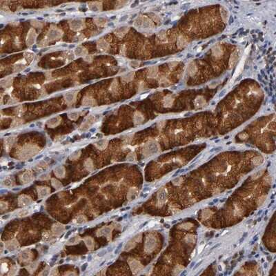 Immunohistochemistry-Paraffin ALG13 Antibody - BSA Free
