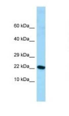 Western Blot: ALG13 Antibody [NBP1-98323] - Titration: 1.0 ug/ml Positive Control: Fetal Stomach.