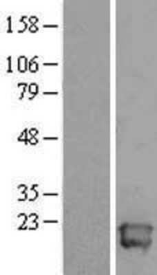 Western Blot: ALG13 Overexpression Lysate (Adult Normal) [NBL1-07465] Left-Empty vector transfected control cell lysate (HEK293 cell lysate); Right -Over-expression Lysate for ALG13.