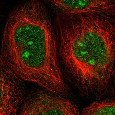 Immunocytochemistry/Immunofluorescence: ALG14 Antibody [NBP2-30914] - Immunofluorescent staining of human cell line A-431 shows localization to nucleus & nucleoli.