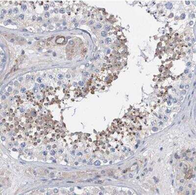 Immunohistochemistry: ALG14 Antibody [NBP2-30914] - Staining of human testis shows strong cytoplasmic positivity in cells of seminiferus ducts.