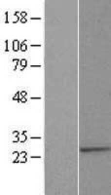 Western Blot: ALG14 Overexpression Lysate (Adult Normal) [NBL1-07466] Left-Empty vector transfected control cell lysate (HEK293 cell lysate); Right -Over-expression Lysate for ALG14.