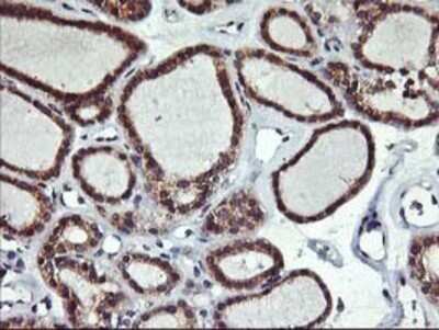 Immunohistochemistry ALG2 Antibody (OTI3C2) - Azide and BSA Free