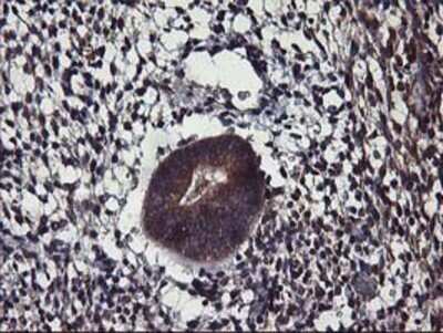 Immunohistochemistry: ALG2 Antibody (OTI3C2) - Azide and BSA Free [NBP2-72308] - Staining of paraffin-embedded Human endometrium tissue using anti-ALG2 mouse monoclonal antibody.