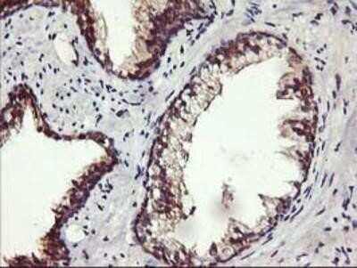 Immunohistochemistry-Paraffin: ALG2 Antibody (OTI3C2) [NBP2-01734] - Staining of paraffin-embedded Human prostate tissue using anti-ALG2 mouse monoclonal antibody.