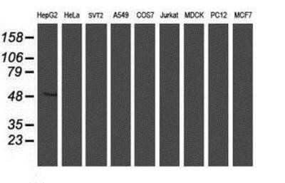 Western Blot ALG2 Antibody (OTI3C2)