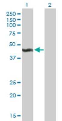Western Blot: ALG2 Antibody [H00085365-B01P] - Analysis of ALG2 expression in transfected 293T cell line by ALG2 polyclonal antibody.  Lane1:ALG2 transfected lysate(45.76 KDa). Lane2:Non-transfected lysate.