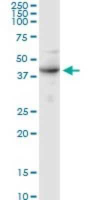 Western Blot ALG2 Antibody - Azide and BSA Free