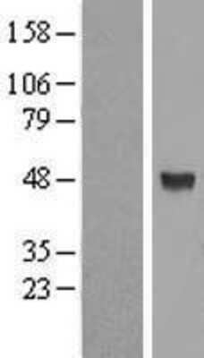 Western Blot: ALG2 Overexpression Lysate (Adult Normal) [NBL1-07467] Left-Empty vector transfected control cell lysate (HEK293 cell lysate); Right -Over-expression Lysate for ALG2.