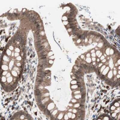 Immunohistochemistry-Paraffin: ALG5 Antibody [NBP1-88767] - Staining of human rectum shows cytoplasmic positivity in glandular cells.