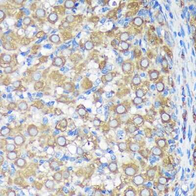 Immunohistochemistry-Paraffin: ALG5 Antibody [NBP2-92371] - Immunohistochemistry of paraffin-embedded Rat ovary using ALG5 Rabbit pAb (NBP2-92371) at dilution of 1:100 (40x lens). Perform microwave antigen retrieval with 10 mM PBS buffer pH 7.2 before commencing with IHC staining protocol.