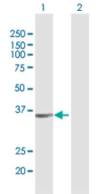 Western Blot: ALG5 Antibody [H00029880-D01P] - Analysis of ALG5 expression in transfected 293T cell line by ALG5 polyclonal antibody.Lane 1: ALG5 transfected lysate(36.90 KDa).Lane 2: Non-transfected lysate.