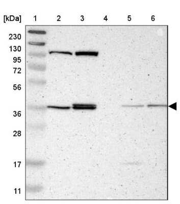 Western Blot ALG5 Antibody - BSA Free