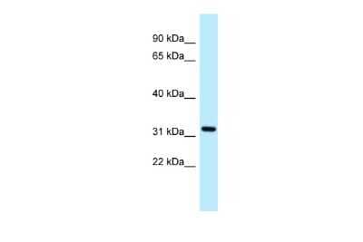 Western Blot: ALG5 Antibody [NBP2-86978] - WB Suggested Anti-ALG5 Antibody. Titration: 1.0 ug/ml. Positive Control: COLO205 Whole CellALG5 is supported by BioGPS gene expression data to be expressed in COLO205