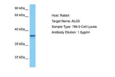 Western Blot: ALG5 Antibody [NBP2-86980] - Host: Rabbit. Target Name: ALG5. Sample Tissue: Human 786-0 Whole Cell lysates. Antibody Dilution: 1ug/ml