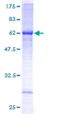 SDS-Page: ALG5 Recombinant Protein [H00029880-P01]