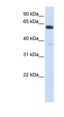 Western Blot: ALG6 Antibody [NBP1-62495] - Human Heart lysate, concentration 0.2-1 ug/ml.