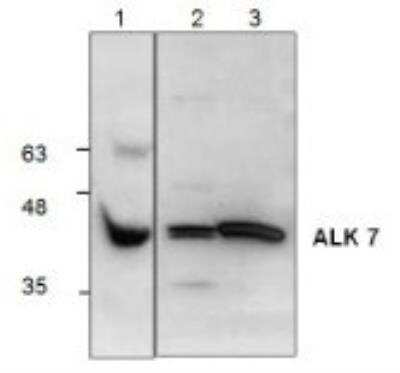 Western Blot: ALK-7/Activin Receptor Type 1C Antibody [NBP1-50659] - Rat kidney tissue (Lane 1); Jurkat cells (Lanes 2 and 3).