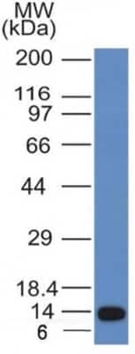 Western Blot: ALK/CD246 Antibody (ALK/1031) - Azide and BSA Free [NBP3-08771] - Western Blot Analysis of Recombinant fragment of ALK/CD246using ALK/CD246Monoclonal Antibody (ALK/1031).