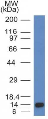 Western Blot: ALK/CD246 Antibody (ALK/1032) - Azide and BSA Free [NBP3-08772] - Western Blot Analysis of Recombinant fragment of ALK/CD246using ALK/CD246 Mouse Monoclonal Antibody (ALK/1032).