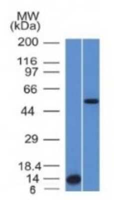 Western Blot: ALK/CD246 Antibody (ALK/1503) [NBP2-54375] - Analysis (A) Recombinant Protein (B) HepG2 Cell lysate Using ALK-1 Monoclonal Antibody (ALK/1503).