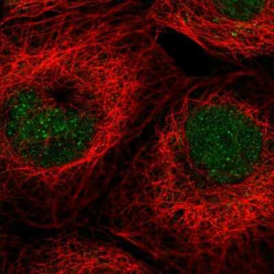 Immunocytochemistry/Immunofluorescence: ALKBH3 Antibody [NBP2-55419] - Staining of human cell line A-431 shows localization to nucleoplasm.