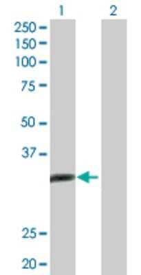 Western Blot: ALKBH3 Antibody [H00221120-D01P] - Analysis of ALKBH3 expression in transfected 293T cell line by ALKBH3 polyclonal antibody.Lane 1: ALKBH3 transfected lysate(33.40 KDa).Lane 2: Non-transfected lysate.