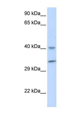 Western Blot: ALKBH3 Antibody [NBP1-57586] - Human Muscle lysate, concentration 0.2-1 ug/ml.