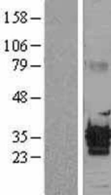 Western Blot: ALKBH3 Overexpression Lysate (Adult Normal) [NBL1-07474] Left-Empty vector transfected control cell lysate (HEK293 cell lysate); Right -Over-expression Lysate for ALKBH3.