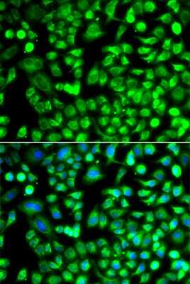 Immunocytochemistry/Immunofluorescence: ALKBH4 Antibody [NBP2-92607] - Analysis of A549 cells using ALKBH4 . Blue: DAPI for nuclear staining.